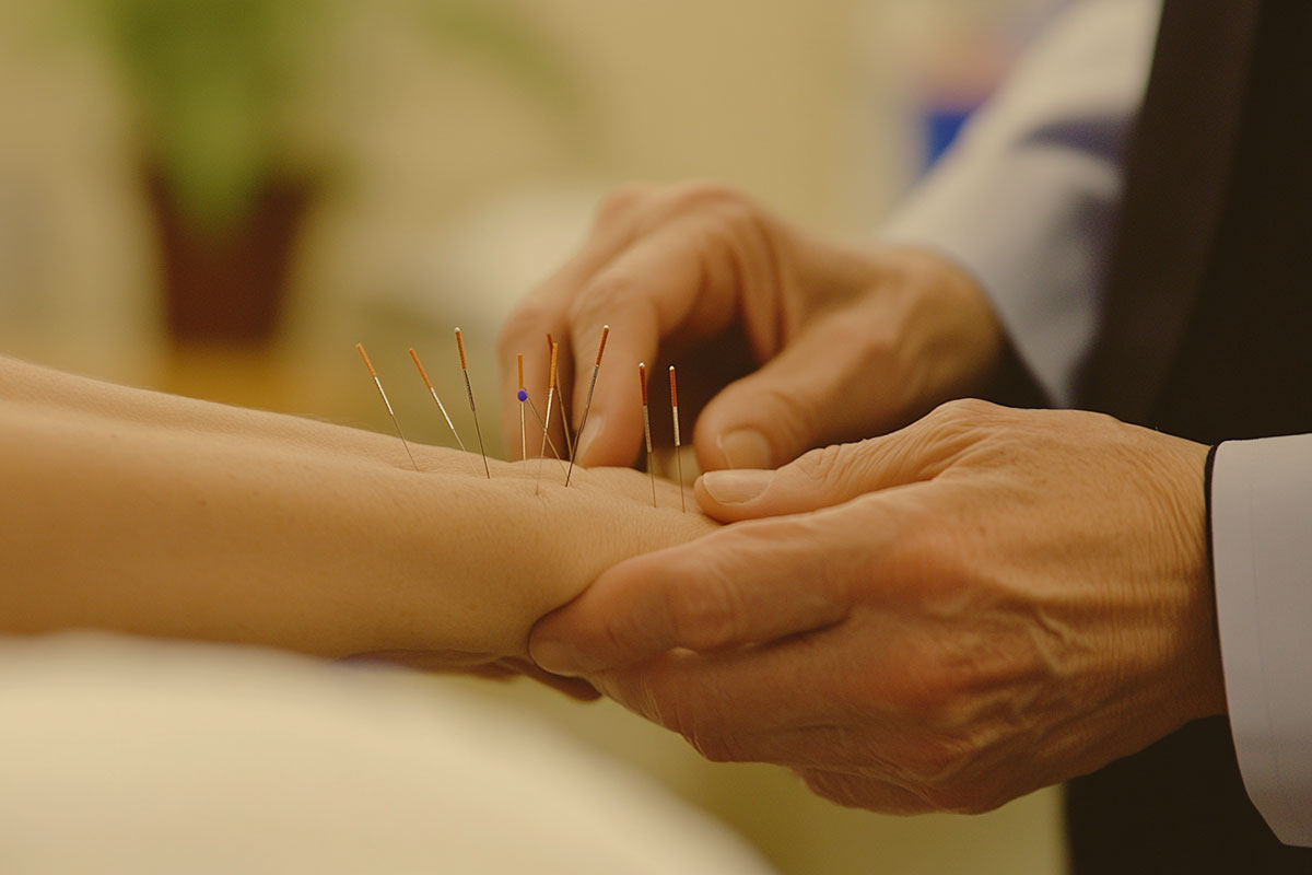 Acupuncture for Post-Chemotherapy Nausea Relief