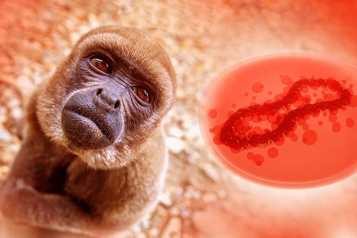 Mpox - Monkeypox: What It Is, Causes, and Symptoms