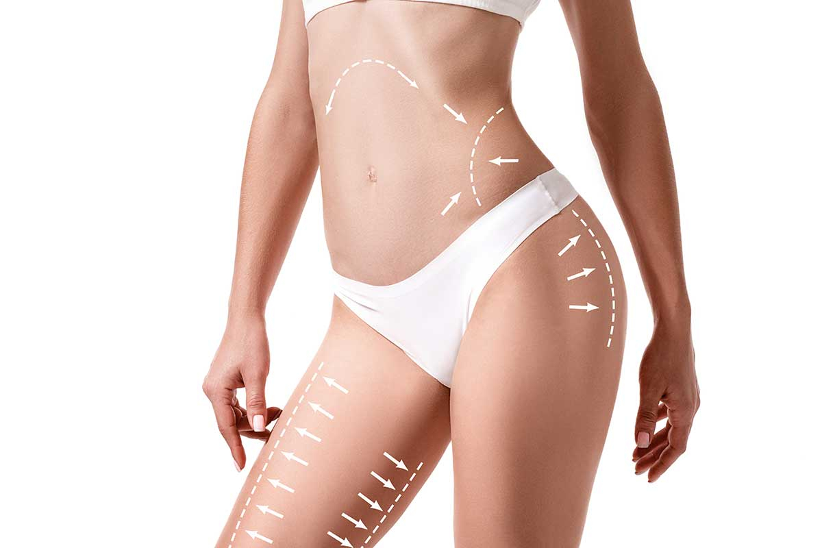 Liposuction in Summerside / PEI