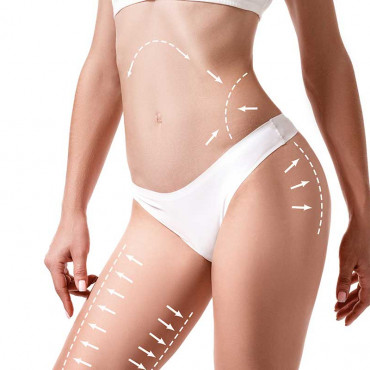 Liposuction em Surrey / BC