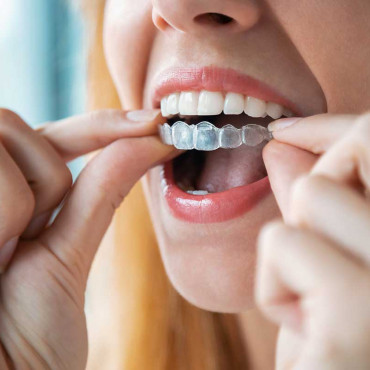 Invisalign em Salaberry-de-Valleyfield / QC