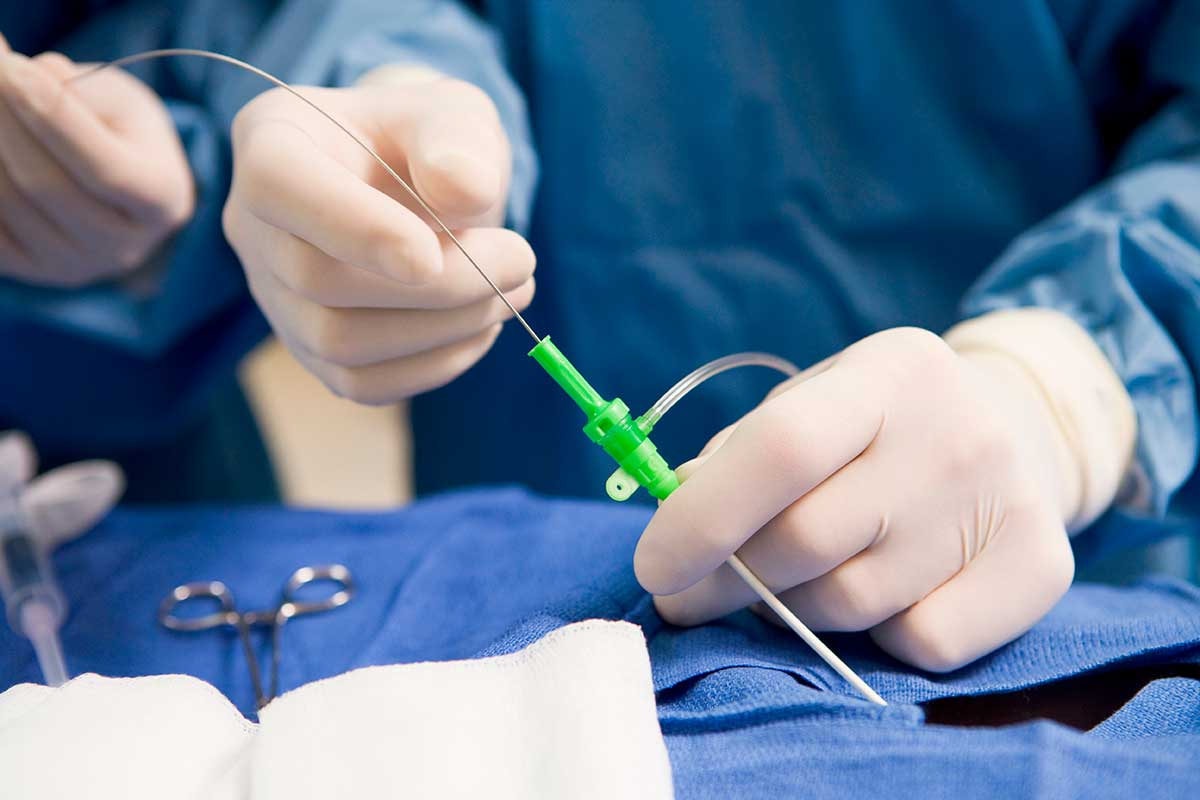 Catheterization in Surrey / BC